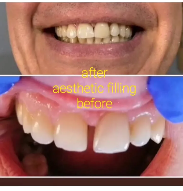 Alanya HEALTHY TEETH Dental Aesthetic — Medicine in Alanya: Online ordering, prices, and reviews