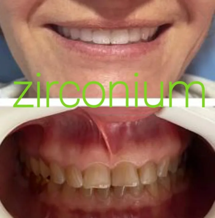 Alanya HEALTHY TEETH Dental Aesthetic — Medicine in Alanya: Online ordering, prices, and reviews