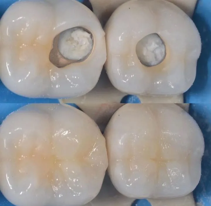 Alanya HEALTHY TEETH Dental Aesthetic — Medicine in Alanya: Online ordering, prices, and reviews