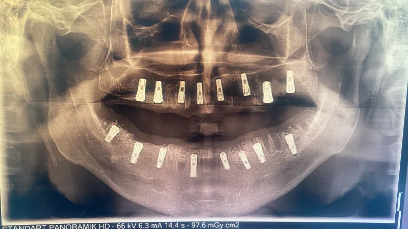 Alanya HEALTHY TEETH Dental Aesthetic — Medicine in Alanya: Online ordering, prices, and reviews