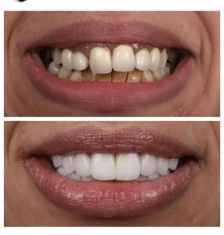 Alanya HEALTHY TEETH Dental Aesthetic — Medicine in Alanya: Online ordering, prices, and reviews