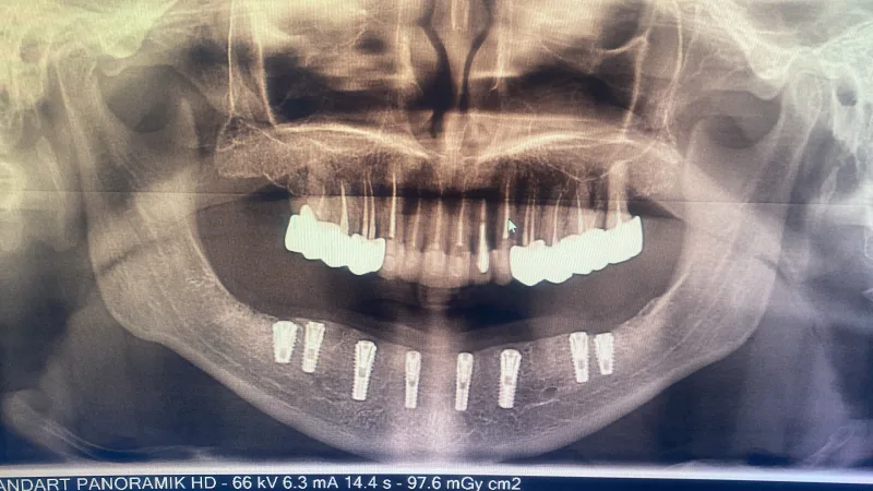 Alanya HEALTHY TEETH Dental Aesthetic — Medicine in Alanya: Online ordering, prices, and reviews