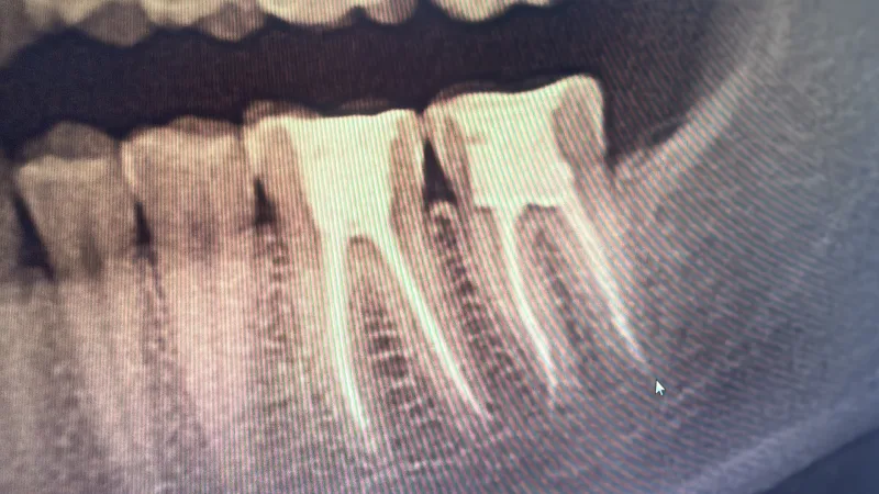 Alanya HEALTHY TEETH Dental Aesthetic — Medicine in Alanya: Online ordering, prices, and reviews