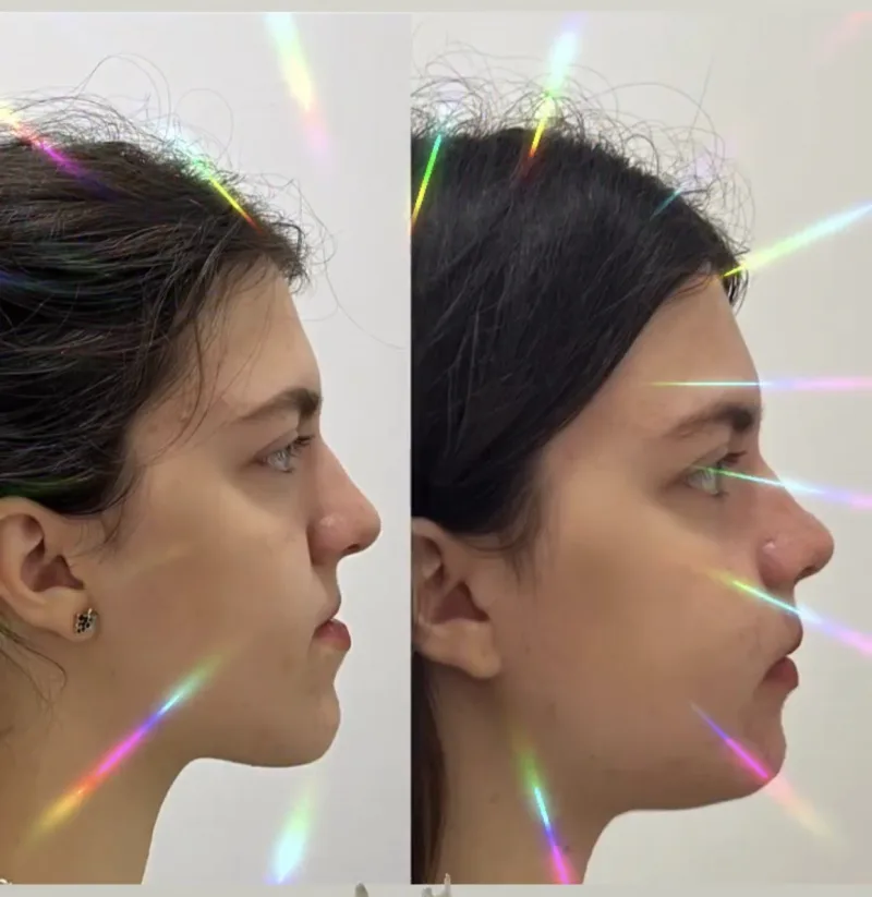 Alanya HEALTHY TEETH Dental Aesthetic — Medicine in Alanya: Online ordering, prices, and reviews